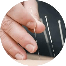 Dry Needling Icon